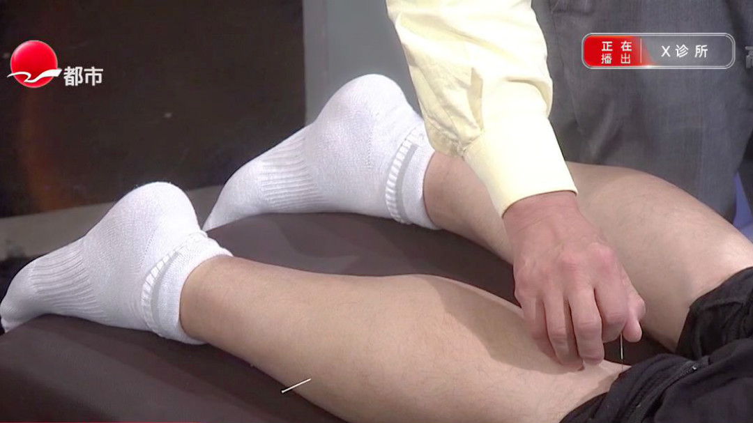 中医保健有妙招 观小腿晓健康