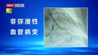 养生堂_20260119_小心“催化剂”伤坏了心