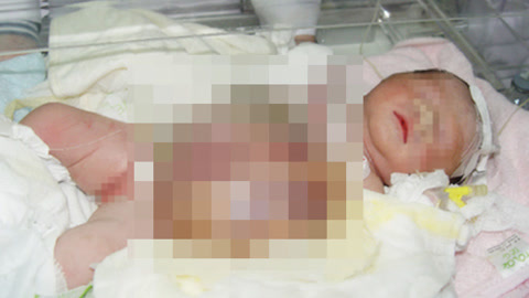 涨健识 慎入！新生儿器官长在体外