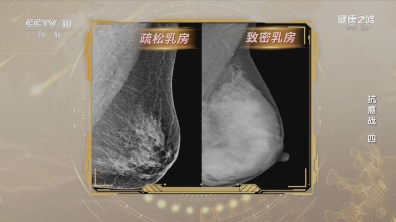 健康之路 《健康之路》 20220417 抗癌战（四）
