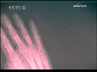 健康之路 意外救治