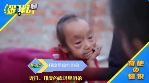 涨健识 印度姐弟同时患上早衰症