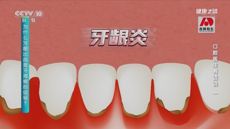 健康之路 《健康之路》 20220918 口腔医生有话说（一）