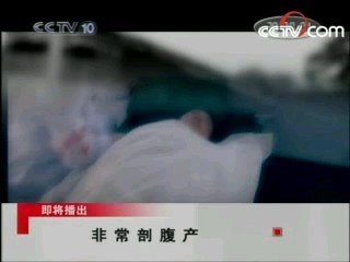走近科学 非常剖腹产