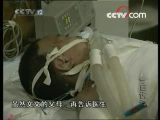 今日说法 灼伤的童年