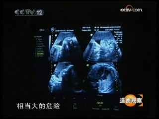 道德观察 绝症妈妈的选择