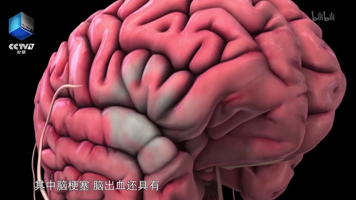 生命的守护急救故事