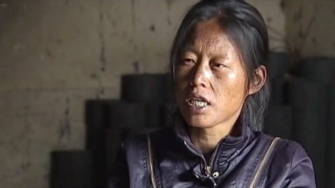 经典传奇 湖南望乡县惊现“变色人” 白净少女变作黑人