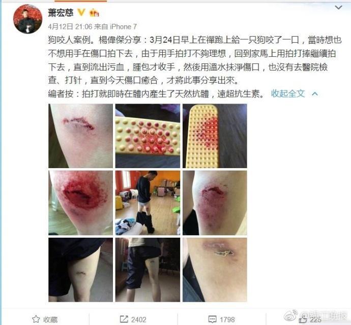 神棍害人!被狗咬伤不让打疫苗 反将伤口打肿