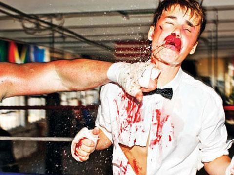 >贾斯汀比伯惨遭暴打