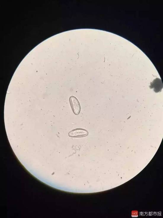 饶虫卵显微镜下图片图片
