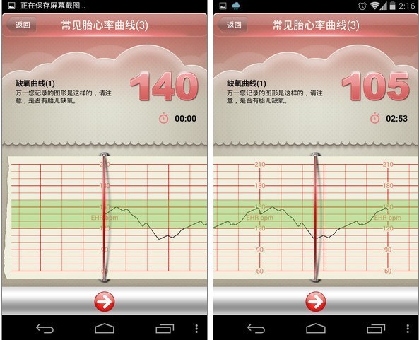 心率过快的原因是什么