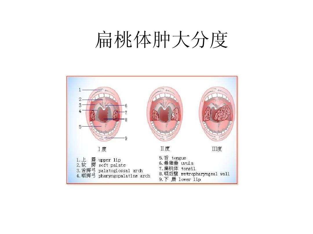 腺樣體手術學平險報銷嗎 學平險住院扁桃體手術